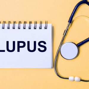 Lupus – Signs, Causes and Types