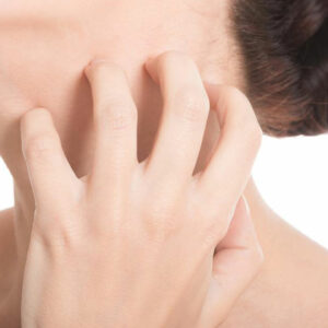 6 common types of eczema disorders you should know about