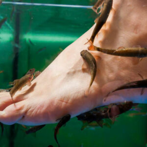 Psoriasis – Types, causes and popular treatments