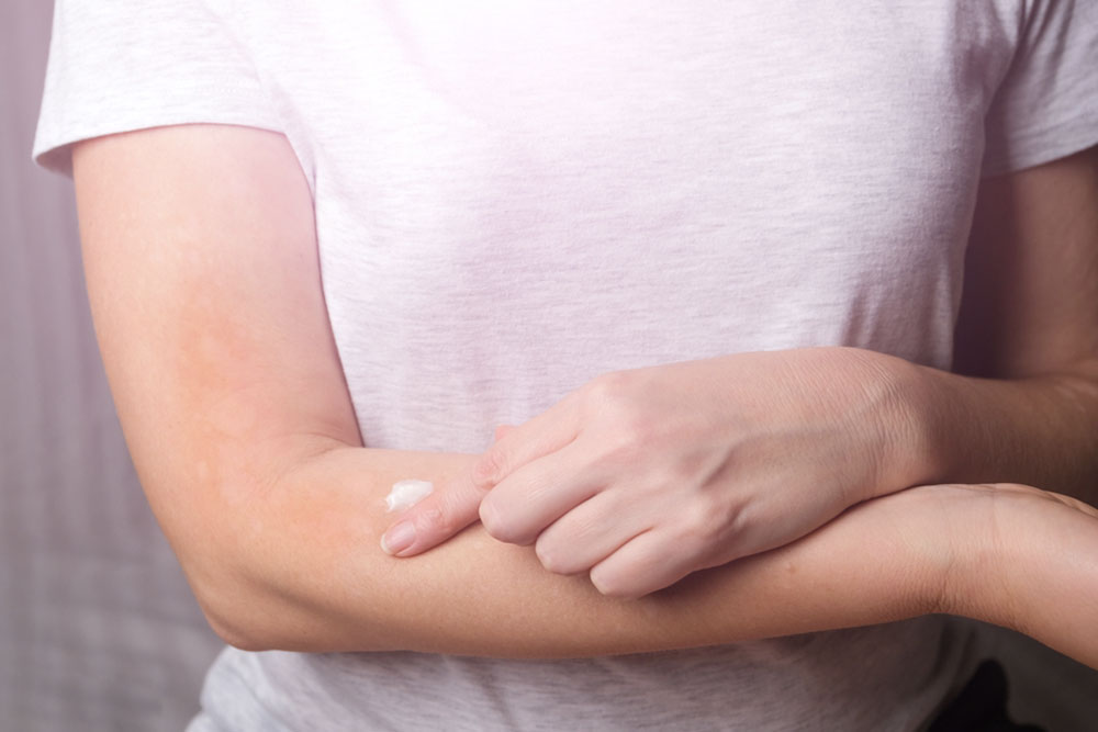 Itchy Skin – Best Anti-Itch Creams and Home Remedies