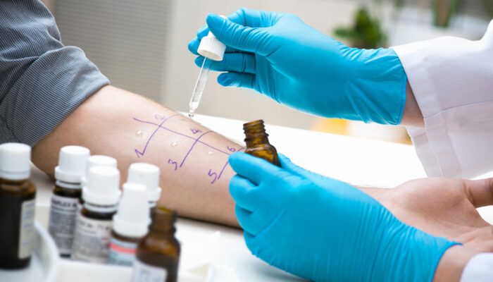 Testing Gluten Sensitivity – Key Symptoms, Methods, and Benefits